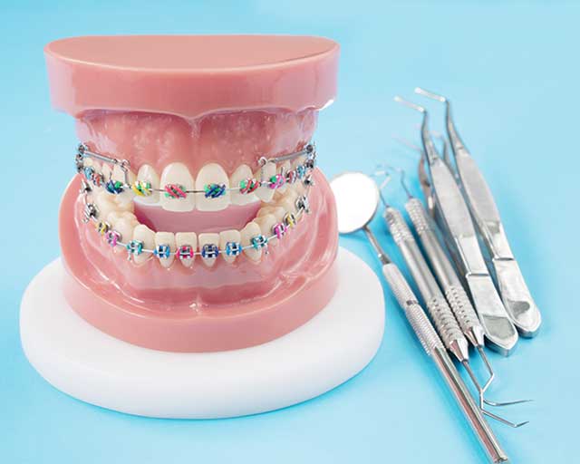 North Hollywood Dentist Orthodontics